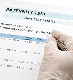 大理妇保院能做DNA鉴定吗，大理医院做亲子鉴定需要提供什么
